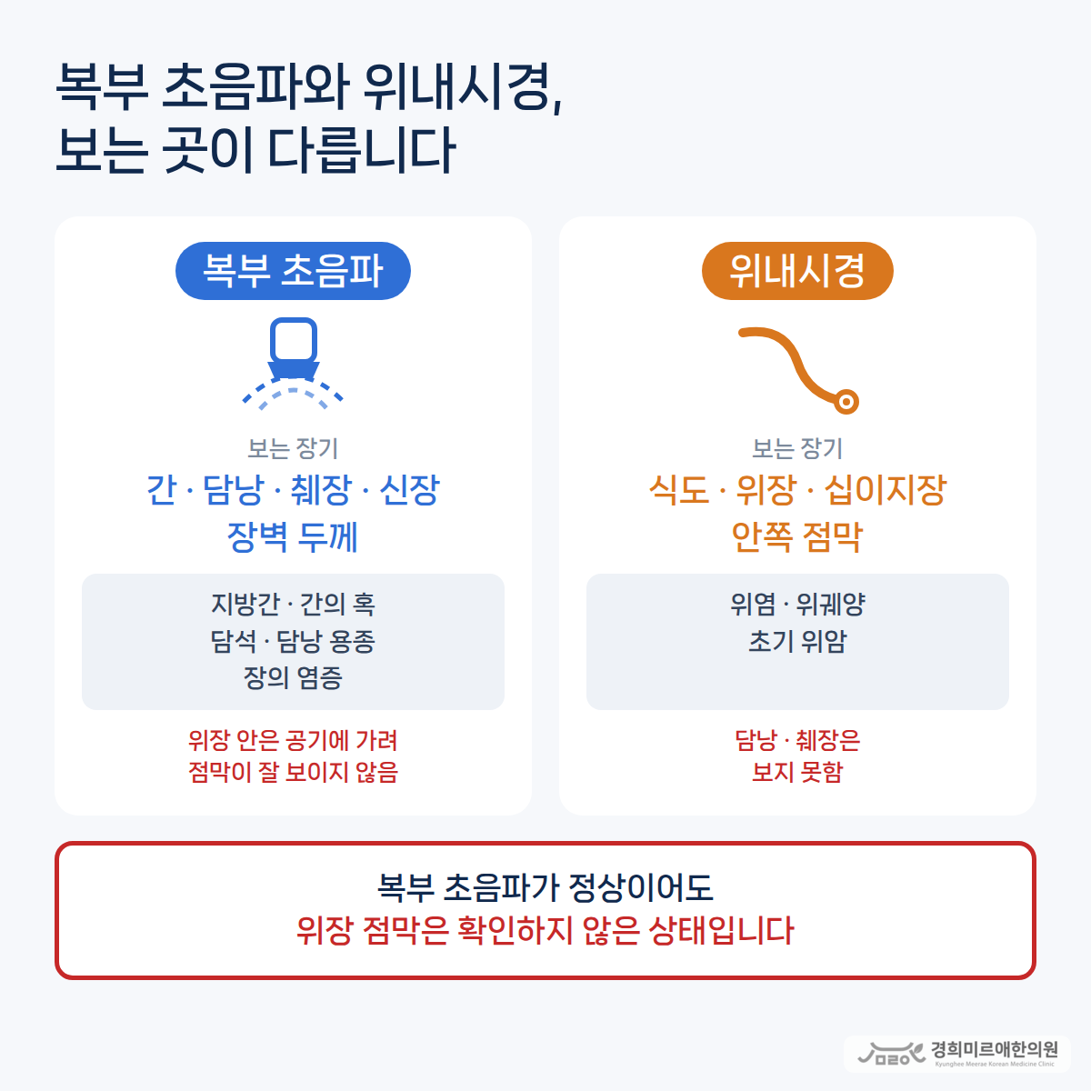 복부초음파랑 위내시경이랑 어떻게 다른가요?