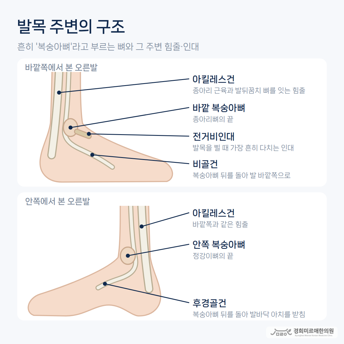 바깥쪽에서 본 오른발의 바깥 복숭아뼈·전거비인대·비골건·아킬레스건과 안쪽에서 본 오른발의 안쪽 복숭아뼈·후경골건을 표시한 구조 도식 — 경희미르애한의원 보라매 발목 구조
