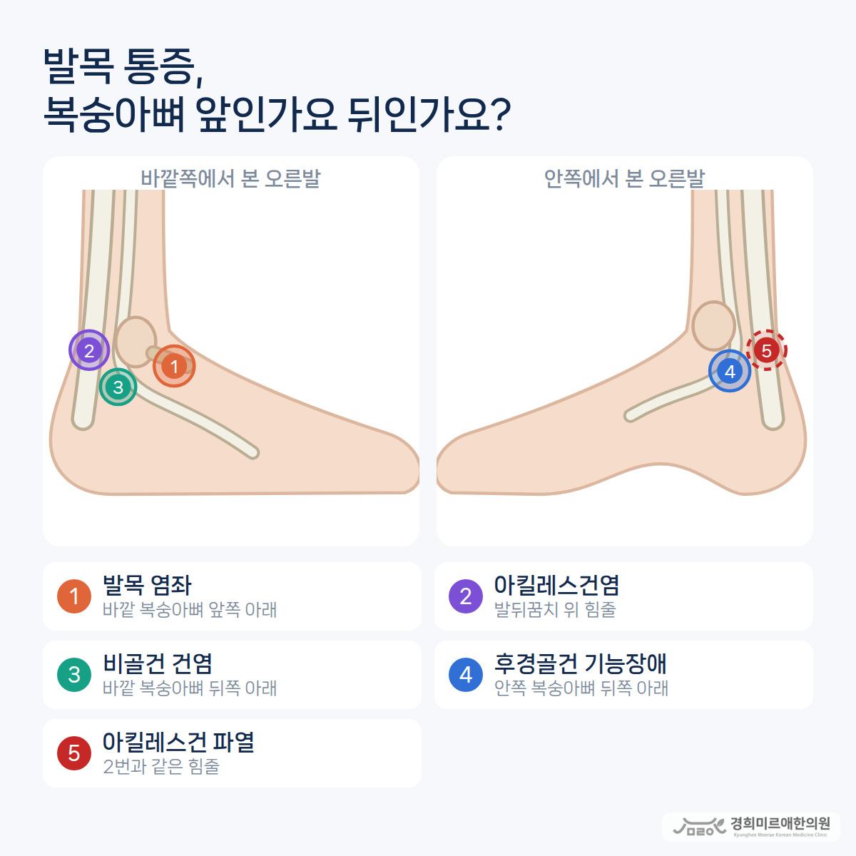 발목 통증이 있으면 다 발목 염좌인가요?