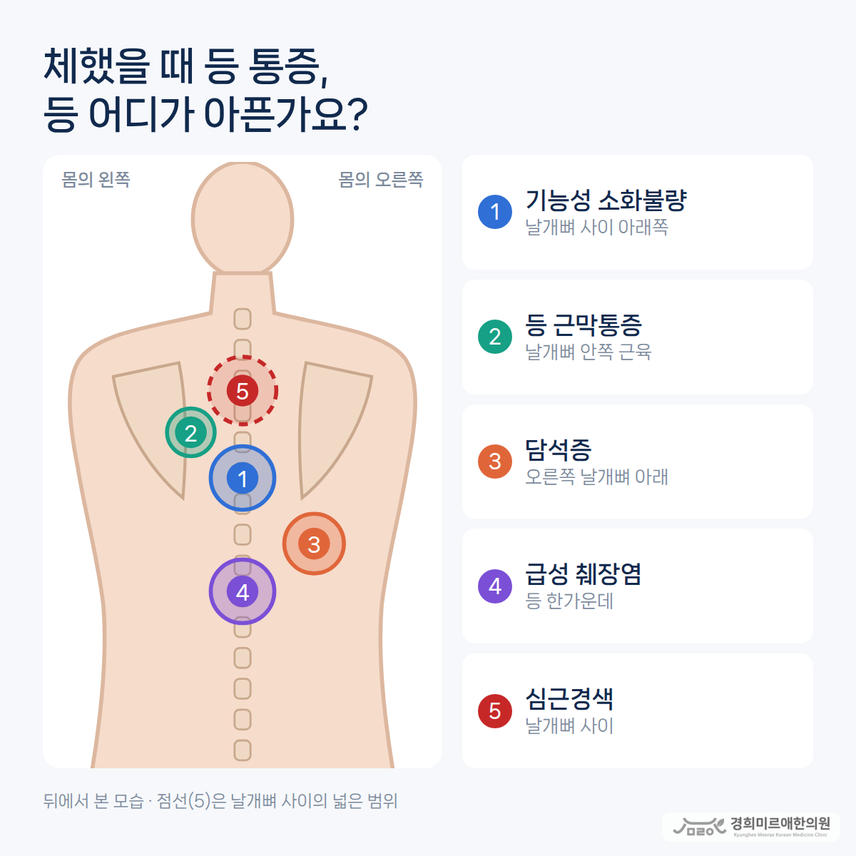 체했을 때 등 통증, 단순 체기일까요?