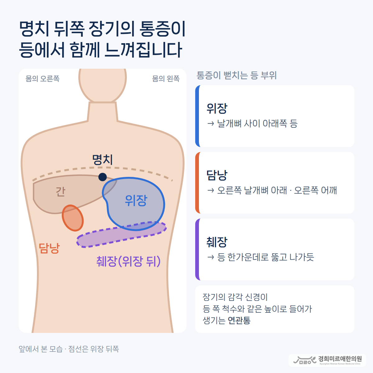 앞에서 본 몸통에 위장·담낭·췌장의 위치와, 각 장기의 통증이 뻗치는 등 부위(날개뼈 사이 아래쪽·오른쪽 날개뼈 아래·등 한가운데)를 이어 표시한 구조 도식 — 경희미르애한의원 보라매 연관통