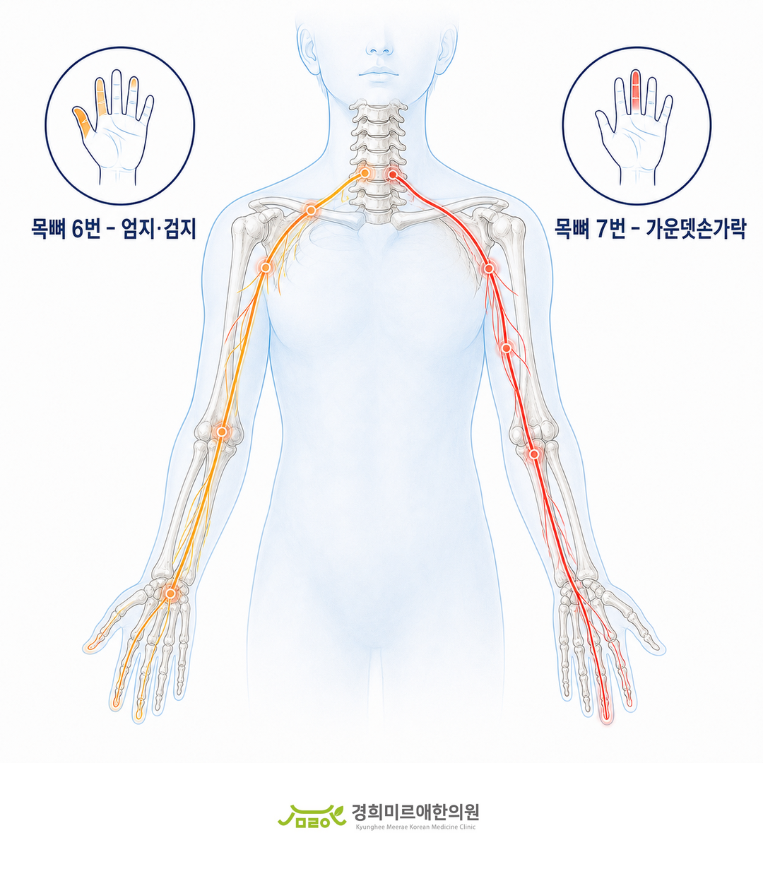 목뼈에서 나온 신경이 손가락까지 이어지는 경로 도식 — 경희미르애한의원 보라매 손저림 원인