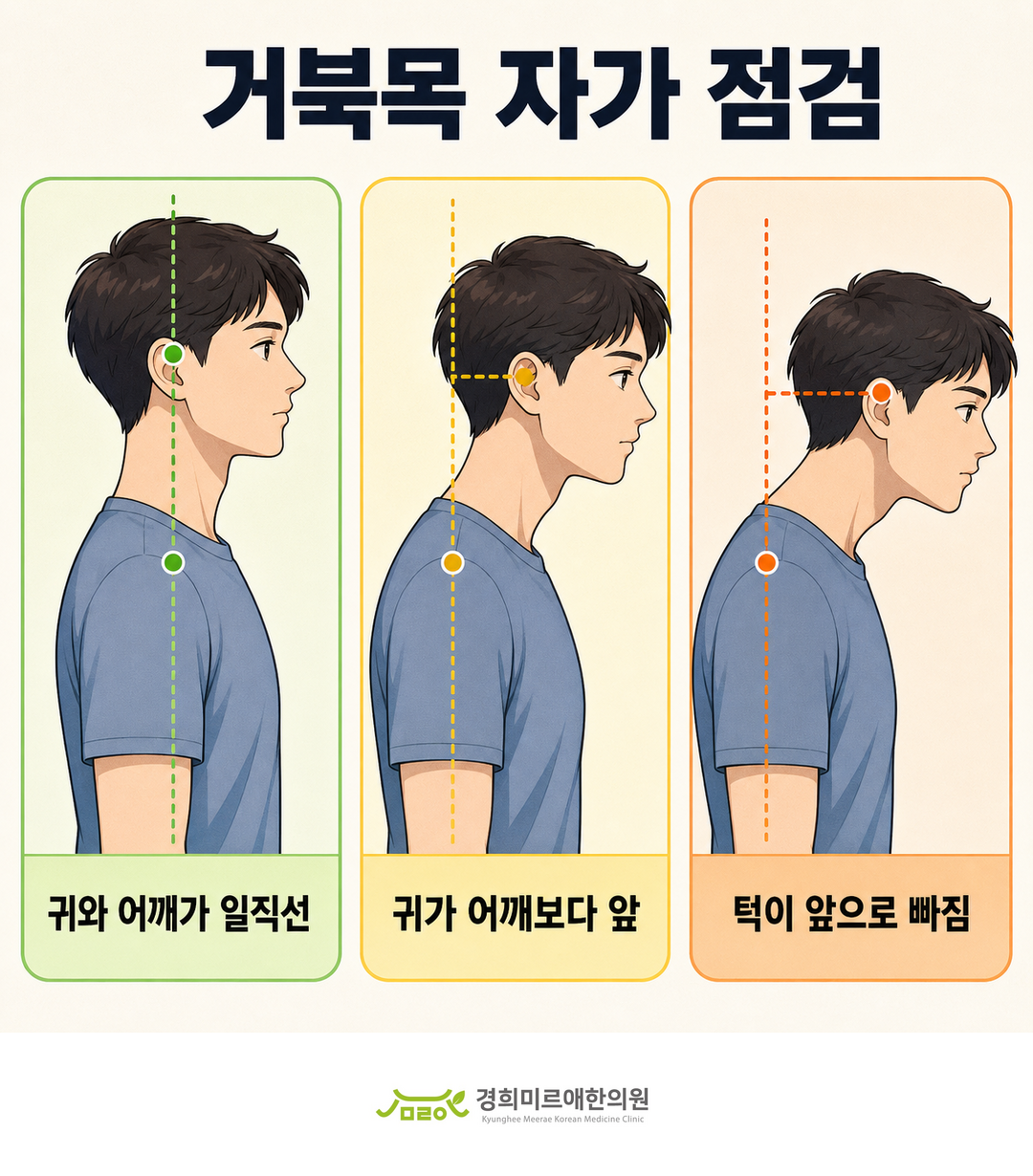 거북목 자가 점검 방법 안내 — 경희미르애한의원 보라매 통증 클리닉