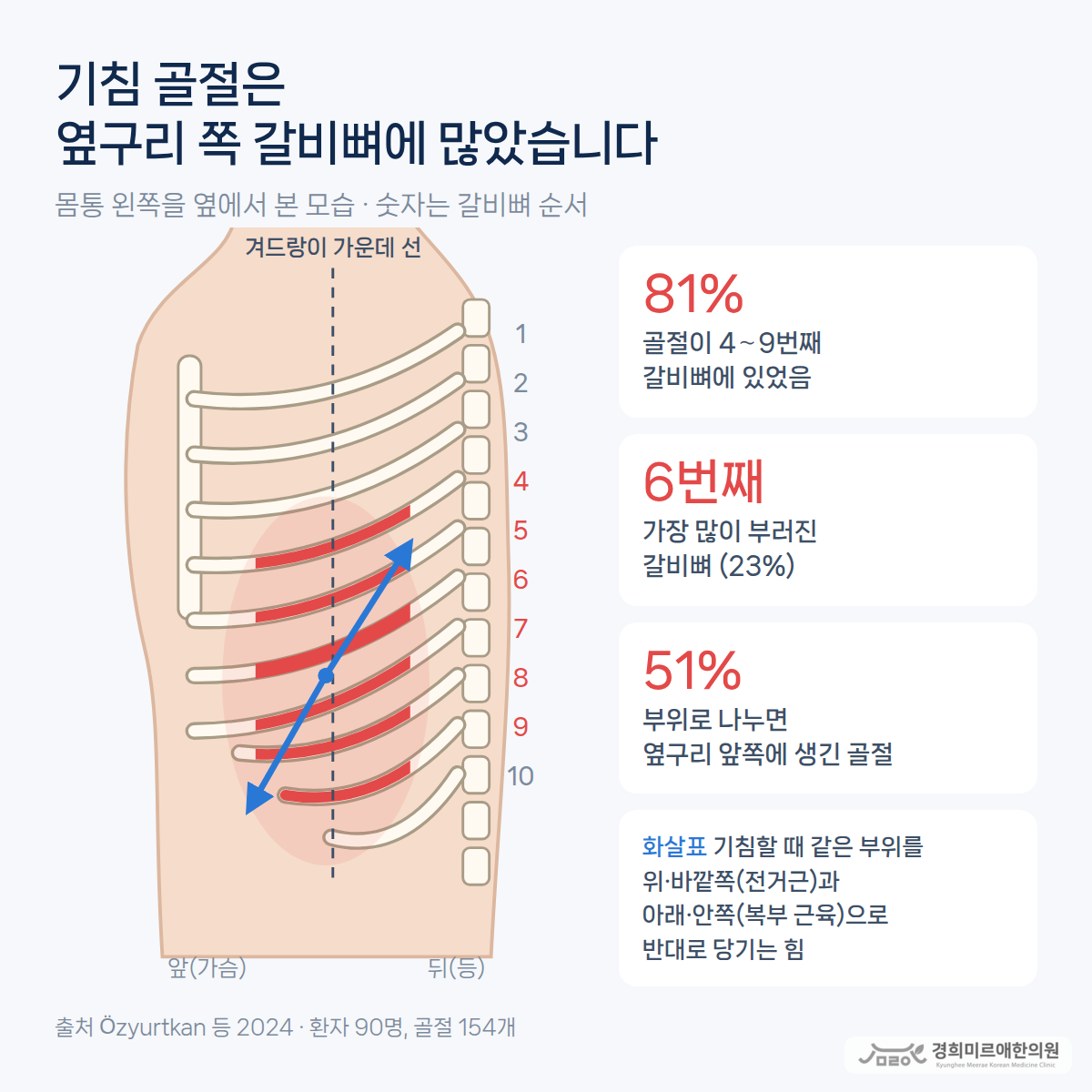 갈비뼈 골절, 기침만 해도 생길 수 있나요?