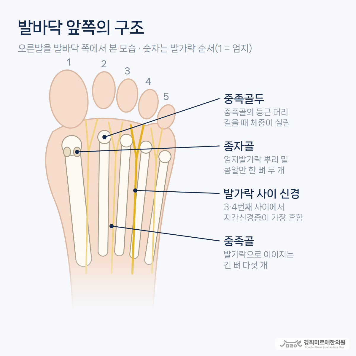 발바닥 쪽에서 본 오른발 앞쪽의 중족골 다섯 개와 중족골두, 엄지발가락 뿌리 밑 종자골 두 개, 발가락 사이를 지나는 신경을 표시한 구조 도식 — 경희미르애한의원 보라매 발 앞쪽 구조