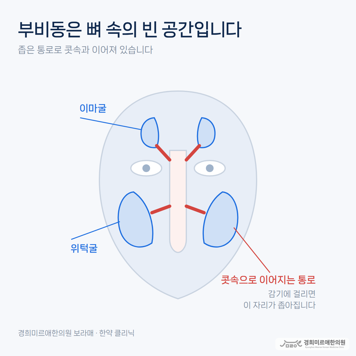 축농증은 저절로 낫나요? 10일과 12주가 기준입니다