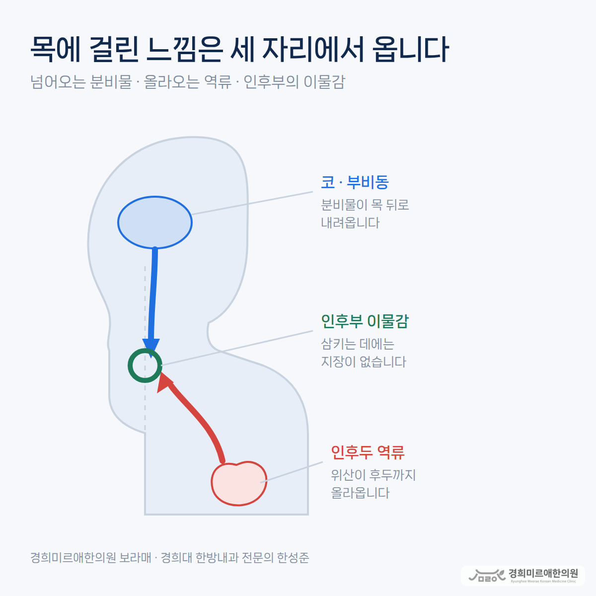 후비루인지 목 이물감인지, 가래가 자꾸 걸린다면