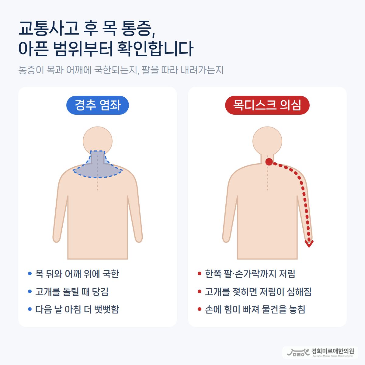 교통사고 후 목 통증, 동작구에서 목디스크와 구분하려면?
